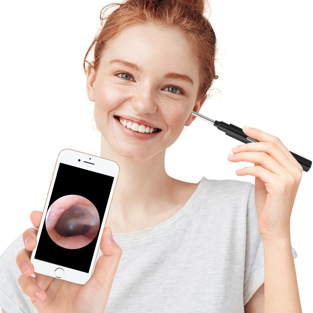 Earwax Cleaner™ (Recarregável e fácil de configurar não precisa de pilhas)