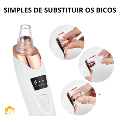 Whitehead Buster Remover de acnes e impurezas faciais (5 em 1)