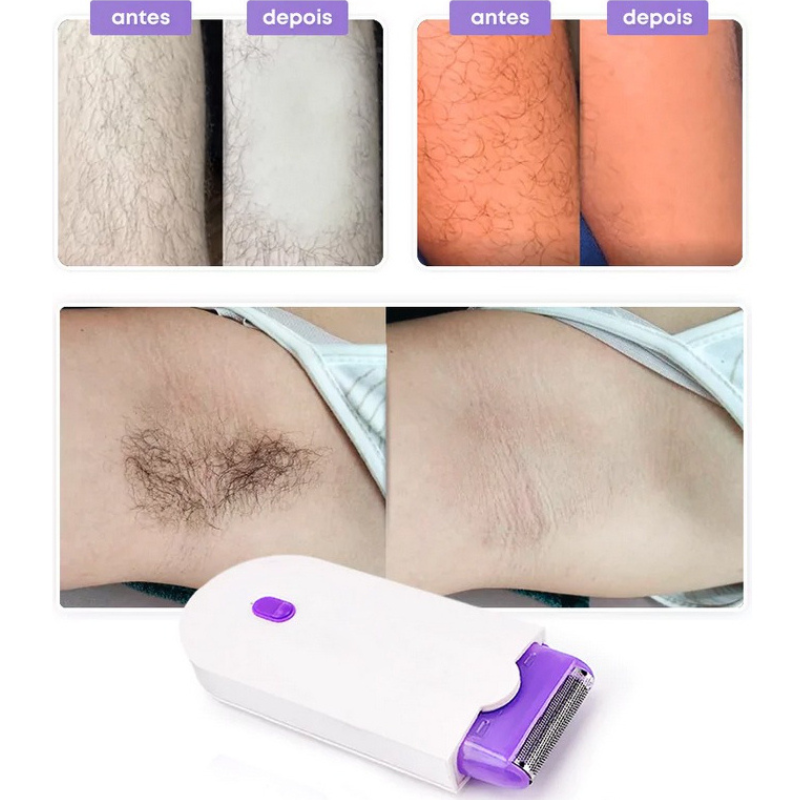 Depilador Indolor a Laser Profissional LaserFlex+ BRINDE