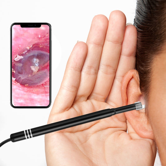 Earwax Cleaner™ (Recarregável e fácil de configurar não precisa de pilhas)