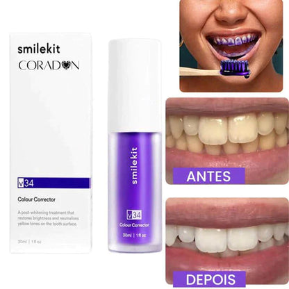SmileEase - Clareador Mágico Dental | Transforme seu sorriso em poucos dias